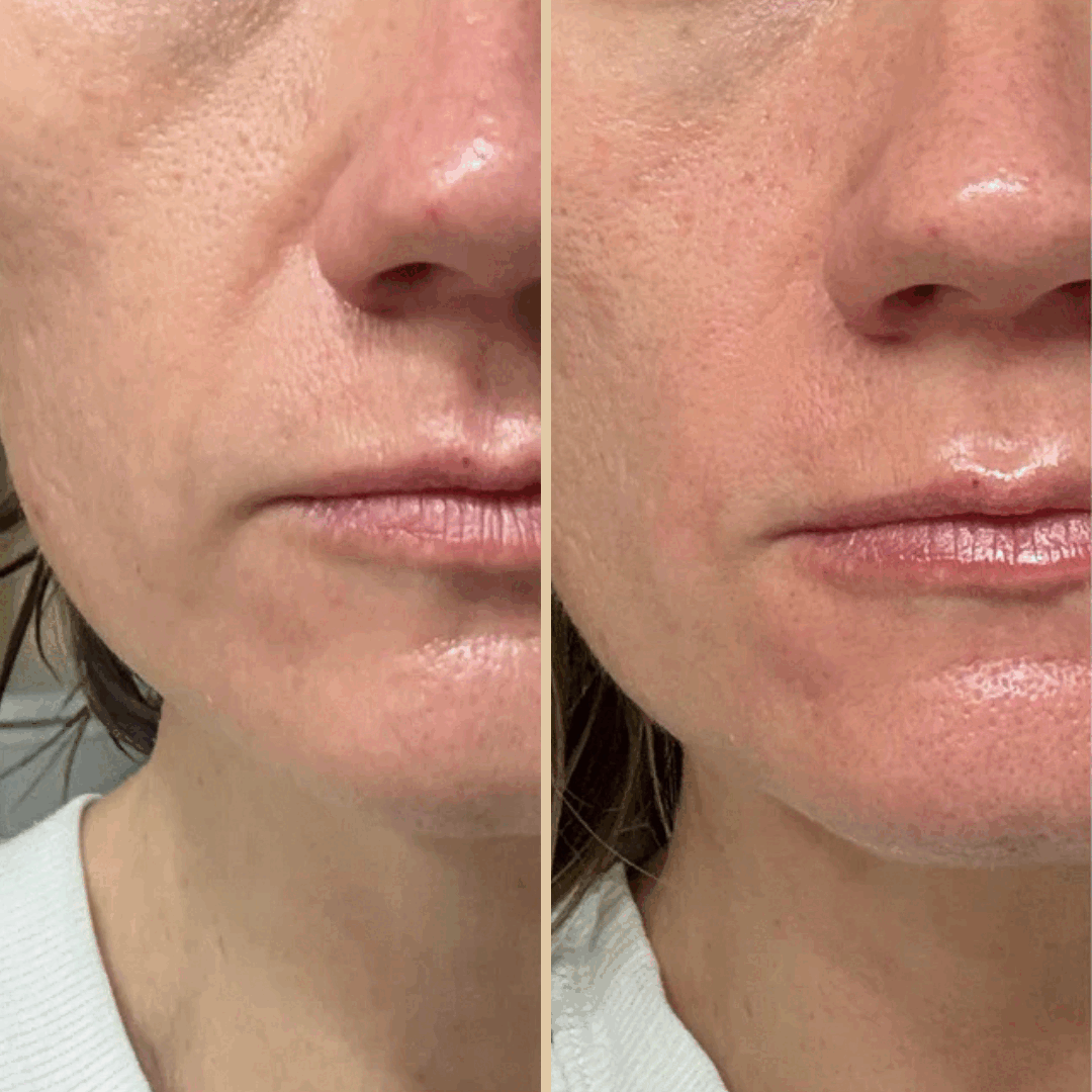 Nurea™ Retinal Liposome Eye Cream