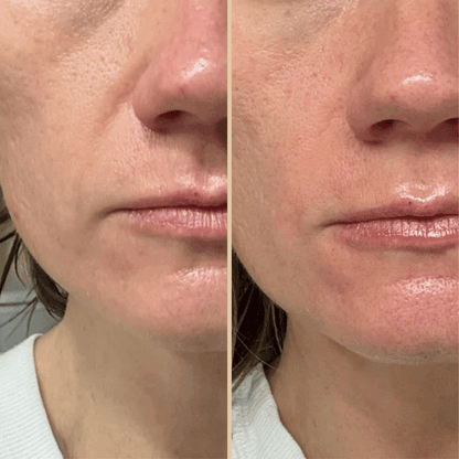 Nurea™ Retinal Liposome Eye Cream