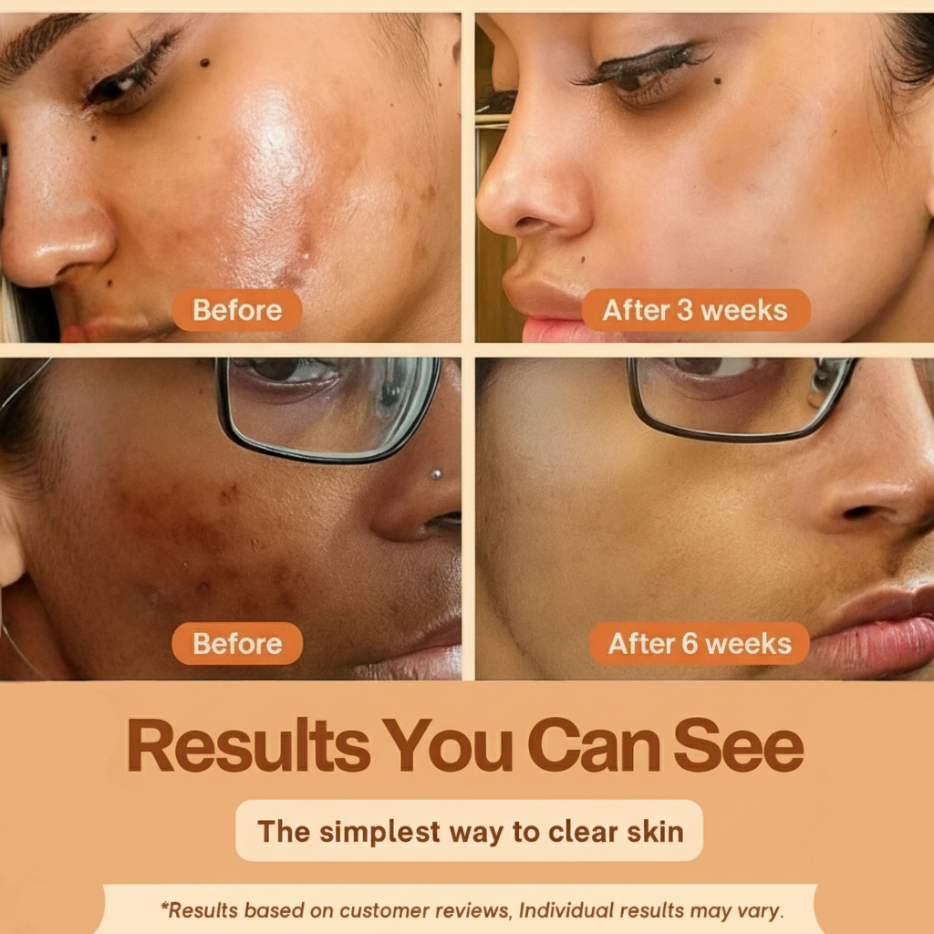 Nurea™ Kojic + Turmeric Peel Spray