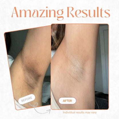 Nurea™ Kojic + Turmeric Peel Spray